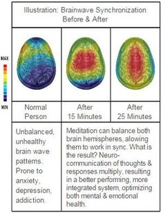 Chakra Health, Brainwave Entrainment, Basic Anatomy And Physiology, Metaphysical Spirituality, Spiritual Psychology, Brain Anatomy, Energy Healing Spirituality, Healing Frequencies