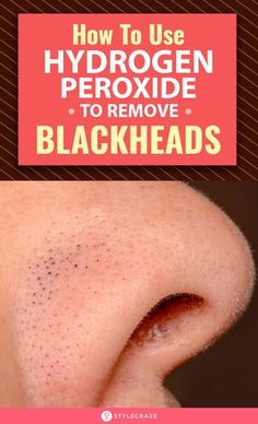 Fitness Hacks, To Remove Blackheads, Blackheads On Nose, Ootd Instagram, Cold Sores Remedies, Remove Blackheads, Natural Sleep Remedies, Cold Home Remedies