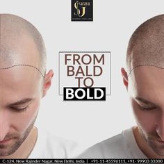 Hair Implants, Prp Hair, Hair Transplant Procedure, Fue Hair Transplant, Hair Transplant Surgery, Best Hair Transplant, Hair Specialist, Hair Dye Colors, Hair Restoration