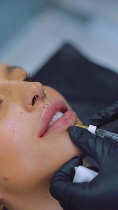 Botox Aesthetic Instagram, Cosmetic Nurse Injector, Lip Injections Aesthetic, Nurse Injector Photoshoot, Top Lip Filler, Lip Injections Before And After, Med Spa Photoshoot, Injection Aesthetic, Lip Filler Shape Ideas