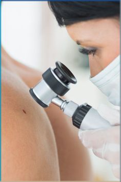 Mo' moles = mo' problems. Vein Removal, Basal Cell, Squamous Cell, Mole Removal, Environmental Factors, Skin Clinic, Plastic Surgeon, Dermatology, Body Skin