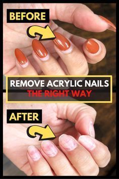 How To Take away Acrylic Nails The Proper Method At Residence! Remove Fake Nails, Nails After Acrylics, Solar Nails, Nail Soak, Gel Nail Removal