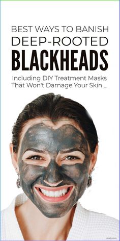 Removing blackheads can badly damage our skin especially if we are removing deep-rooted blackheads. But it is possible to remove even deep-rooted blackheads gently. And better still it is possible to tackle the causes of Skincare Blackheads, Diy Masks, Black Head Remover Mask, Blackhead Mask, Exfoliating Face, Face Care Routine, Blackhead Removal, Diy Facial, Natural Sleep Remedies