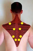 Trapezius (traps) pinching stinging, headaches, repetitive pinching stinging… Massage Modalities, Trapezius Muscle, Referred Pain, Back Pain Remedies, Shoulder Massage, Health Living