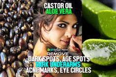 cure acne pimples, dark circles under eye, foots, home remedies for Dark spots circles, Lemon for dark spots, neck, Remove Acne scars, Remove dark spots on hands, Remove dark/brown spots, skin care, Dark Spots Products, Oil For Dark Spots, Dark Spots Under Eyes, Dark Spots On Legs, Brown Spots On Skin, Coconut Oil For Acne, Firming Eye Cream, Skin Spots