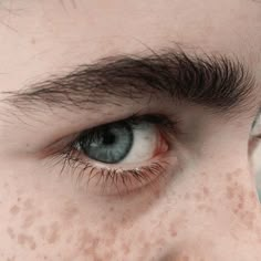 a man with freckles on his face and blue eyes looking at the camera