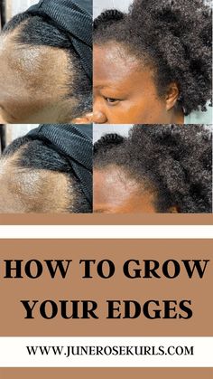 How I regrew my edges due to postpartum shedding. Regrow Edges Natural Hair, Hair Edges Growth Tips, Edges Growth, Natural Hair Edges Growth Tips, Edges Growth For Natural Hair, Growing Edges Back Hair Natural, Growing Back Edges, Rapid Hair Growth Diy, Edges Growth Tips