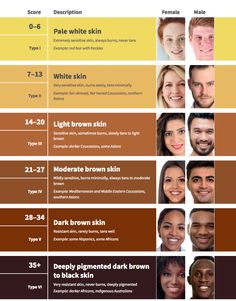 Skin Type Test, Type Classification, Esthetician Quotes, Pale White Skin