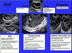 an image of different types of stomachs