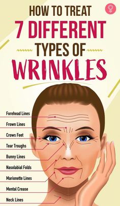 Nobody likes to have wrinkles on their face. But eventually, we’re all going to get a few lines because we are aging and nobody can stop time. Wrinkles Remedies Face, Wrinkle Free Skin, Forehead Wrinkles, Deep Skin