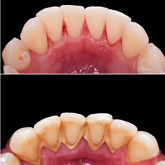 Dental Scaling, Baking Drawing, Dental Content, Dental Wallpaper, Hair And Skin Vitamins, Dentistry Student