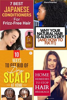 hair regrowth conditioner Frizz Free Hair, Dry Scalp, Frizz Free, Free Hair, Home Remedies, Natural Hair Styles