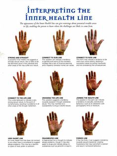 Palm Reading Lines, Palm Reading Charts, Palmistry Reading, Witchcraft Spells For Beginners, Low Thyroid, Thyroid Symptoms, Inner Health, Palm Reader, Magick Book