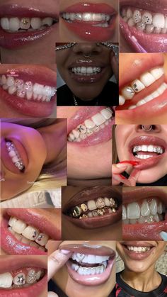 Teeth Caps, Gem Tattoo, Tooth Gems, Bad Barbie