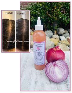 Our specially formulated Red Onion Hair Tonic is infused with a blend of powerful and essential ingredients, including red onion, MSM, Vitamin E, rice oil, and glycerin, that work extremly well together to promote healthy hair growth, stimulate regrowth and repair follicles, reduce hair fall and also improve hair elasticity.  The high levels of sulfur, vitamins, and minerals in our unique formulation provide the necessary nourishment to the hair and scalp, promoting new growth and thickness, whi Msm Vitamin, Regrow Thinning Hair, Onion Hair, Natural Shampoo And Conditioner, Onion For Hair, Breaking Hair, Stimulate Hair Follicles, Hair Tonic, Promote Healthy Hair Growth