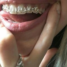 Pretty Teeth, Silver Grillz, Dental Jewelry, Grillz Teeth, Teeth Caps, Diamond Teeth, Dope Jewelry Accessories, Grills Teeth, Teeth Braces