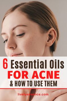 Here's a list of essential oils that will help you get clear skin. They are the most effective for treating scars, pimples, and breakouts; reducing inflammation in your face without ever making it look greasy or oily with their antimicrobial properties! #essentialoils #acne Reducing Inflammation