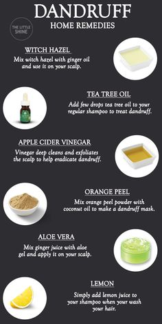 Alovera For Dandruff, How To Get Rid Of Hair Dandruff, How To Deal With Dandruff Dry Scalp, Remedies For Dandruff And Itchy Scalp, What Helps With Dandruff, Instant Dandruff Removal, Get Rid Of Dandruff Naturally, Dandruff Remedy Diy How To Get Rid, Best Remedy For Dandruff