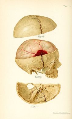 an old medical illustration shows the inside of a human skull