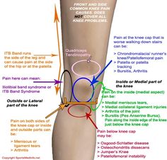 Knee Pain Relief Exercises, Knee Strengthening Exercises, How To Strengthen Knees, Knee Problem, Knee Pain Exercises, Knee Cap, Knee Exercises, Knee Pain Relief, Knee Replacement