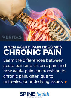 Medical illustration showing pain that surrounds the cervical and thoracic regions of the spine Neck Pain, Chronic Pain, Conditioner, Health