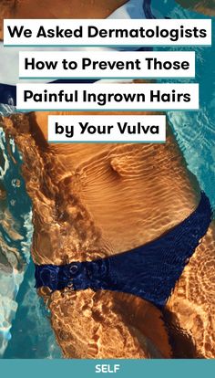 Asking for a friend (that friend is you): Here's how dermatologists recommend you prevent ingrown hairs. Scrubs Diy, Infected Ingrown Hair, Best Epilator, Ingrown Hair Remedies, Girl Hacks, Ingrown Hair Removal, Shaving Tips, Prevent Ingrown Hairs, Keratosis Pilaris