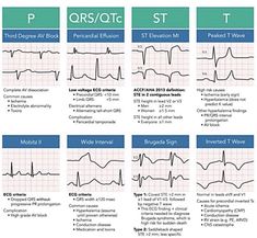 Cath Lab Nursing, St Elevation, Pericardial Effusion, Posts On Instagram