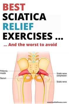 the best sciatica relief exercises and the worst to avoid by david s schick