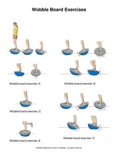 Wobble Board Exercises, Peroneal Tendon, Acl Rehab, Acl Recovery, Acl Surgery