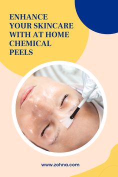 Discover the best at home chemical peel options with our guide to 25 safe and effective treatments. Learn about their benefits, compare brands, and find trusted sources to purchase these transformative skincare products. #AtHomeChemicalPeels #AtHomeChemicalPeelForAcneScars Diy Chemical Peel, At Home Chemical Peel, Chemical Peel At Home, Face Peel, Chemical Peels