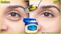 Eye Wrinkles Remedies, Puffy Bags, Puffy Eyes Remedy, Bags Under Eyes, Remove Eye Bags, Mascara Hacks