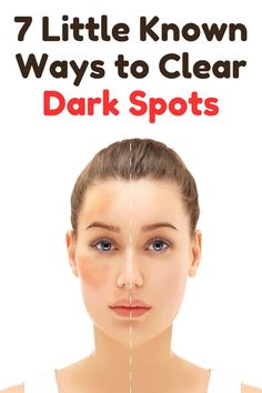 Diy Facial Moisturizer, Dark Spots Remedies, Anti Aging Remedies, Erase Wrinkles, Dark Spots On Face, Lighten Dark Spots