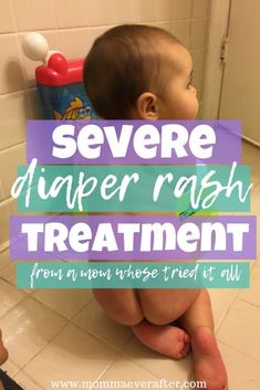 a baby is sitting on the floor in front of a mirror with text overlay saying severe diaper rashh treatment from a vein tried at all