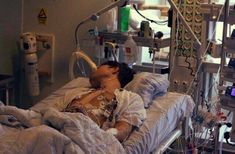 a man laying in a hospital bed with an oxygen tube attached to his arm and head