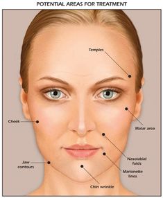 Chin Wrinkles, Finding Confidence, Filler Injection, Derma Fillers, Facial Aging, Face Fillers, Surgical Procedures, Facial Fillers, Injectables Fillers