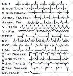 Ekg Technician Aesthetic, Ekg Interpretation Made Easy, Ekg Tech, Cardiac Health, Ekg Technician, Er Tech, Medical Assistant Student, Prostate Health Men