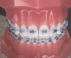 Periwinkle Braces, Dental Braces Colors, Braces Colors Combinations, Braces And Glasses, Braces Food, Cute Braces Colors, Pretty Teeth, Braces Tips, Getting Braces