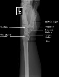 an x - ray shows the location of the foot and ankle bones in this image