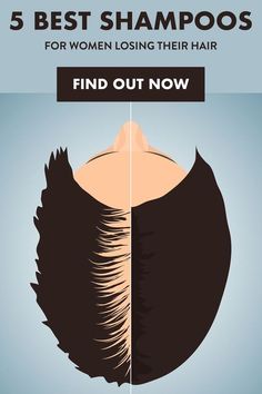 5 Best Shampoos For Women Losing Their Hair Hair Help, Hair Remedies, Shampoos, Hair Shampoo, Hair Health, Up Girl