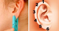 Tiredness Remedies, Ear Reflexology, Bolesti Chrbta, Sensory System, Ear Parts, Body Organs, Reflexology, Natural Home Remedies, Sciatica