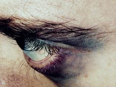 a close up of an eye with tears on it's iris and eyelashes