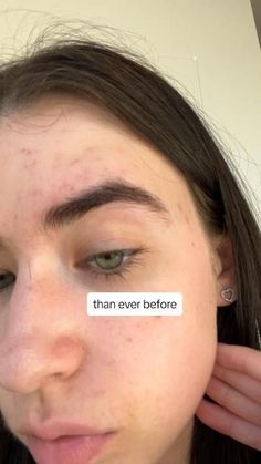 Best Brow Growth Serum, Lash Serum The Ordinary, The Ordinary Lash Serum Before And After, The Ordinary Lash Serum, Best Eyebrow Growth Serum, Thicker Brows, Lash And Brow Serum, Grow Eyebrows Thicker, Brows And Lashes