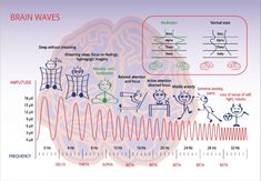 About Brain, Deep Brain Stimulation, Insomnia Causes, Electromagnetic Spectrum, Brain Stimulation, Mental Health Facts, Yoga Therapy, Brain Activities, Brain Waves