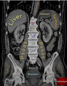 an x - ray shows the location of the liver and its surrounding areas, including the rib