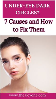 Dark circles making you look tired? Find out the top 7 causes behind those pesky shadows and learn how to diminish their appearance with expert-recommended remedies. Get tips on how to restore a brighter, refreshed look! Say Goodbye, Your Eyes