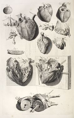 an old drawing of various types of heart surgery