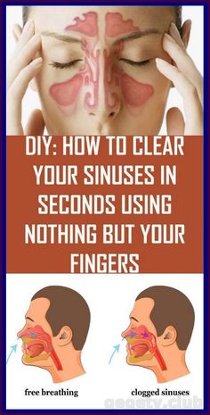 Sinus Blockage, Clogged Sinuses, Clear Your Sinuses, Blocked Sinuses, Lymph Drainage Massage, Blocked Nose, Cold Or Allergies, Lymph Fluid, Lymph Drainage