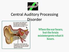 Raising A Child With Auditory Processing Disorder: Slide Presentation in Common Language on What Auditory Processing Disorder Is (for your friends, family, teachers, etc.) Auditory Processing Disorder Activities, Central Auditory Processing, Auditory Processing Activities, Organize Everything, Slide Presentation, Processing Disorder