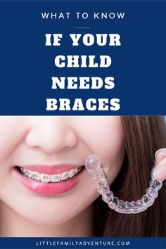 What to Know if Your Child Needs Braces Perfect Smile, Family Lifestyle, Braces, Parenting Hacks, How To Know, Real Food Recipes, Need To Know, Parenting