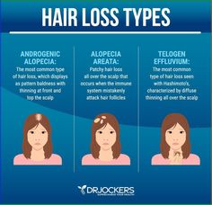 Female hair loss can be frustrating or even embarrassing. Discover the root causes and natural support strategies for healthy hair growth. Coconut Oil Hair Mask Diy, Skincare Content, For Healthy Hair Growth, Androgenic Alopecia, Slow Hair Growth, Extreme Hair Growth, Lip Care Routine, For Healthy Hair, Female Hair